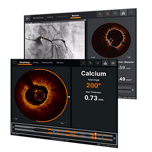 Die optische Kohärenztomografie bietet genaue Bilder